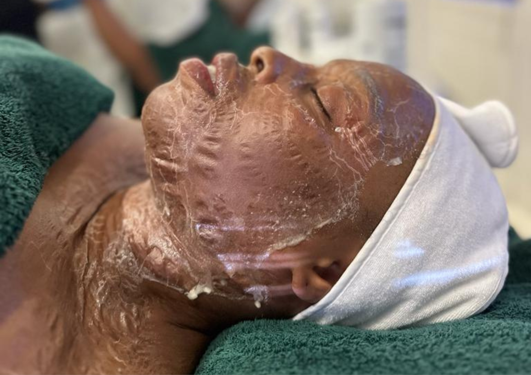 Facial Treatments